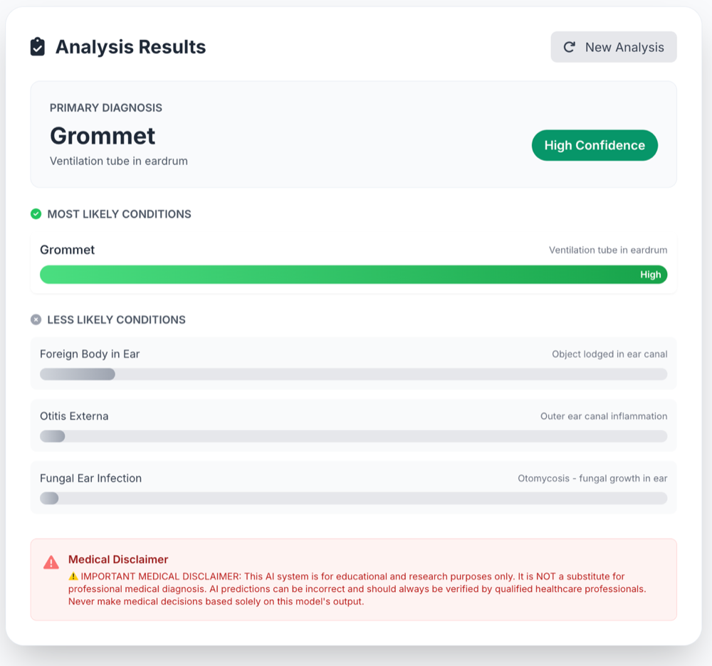 OtoSensAI analysis results screen showing a Grommet diagnosis with high confidence and the ranked differential